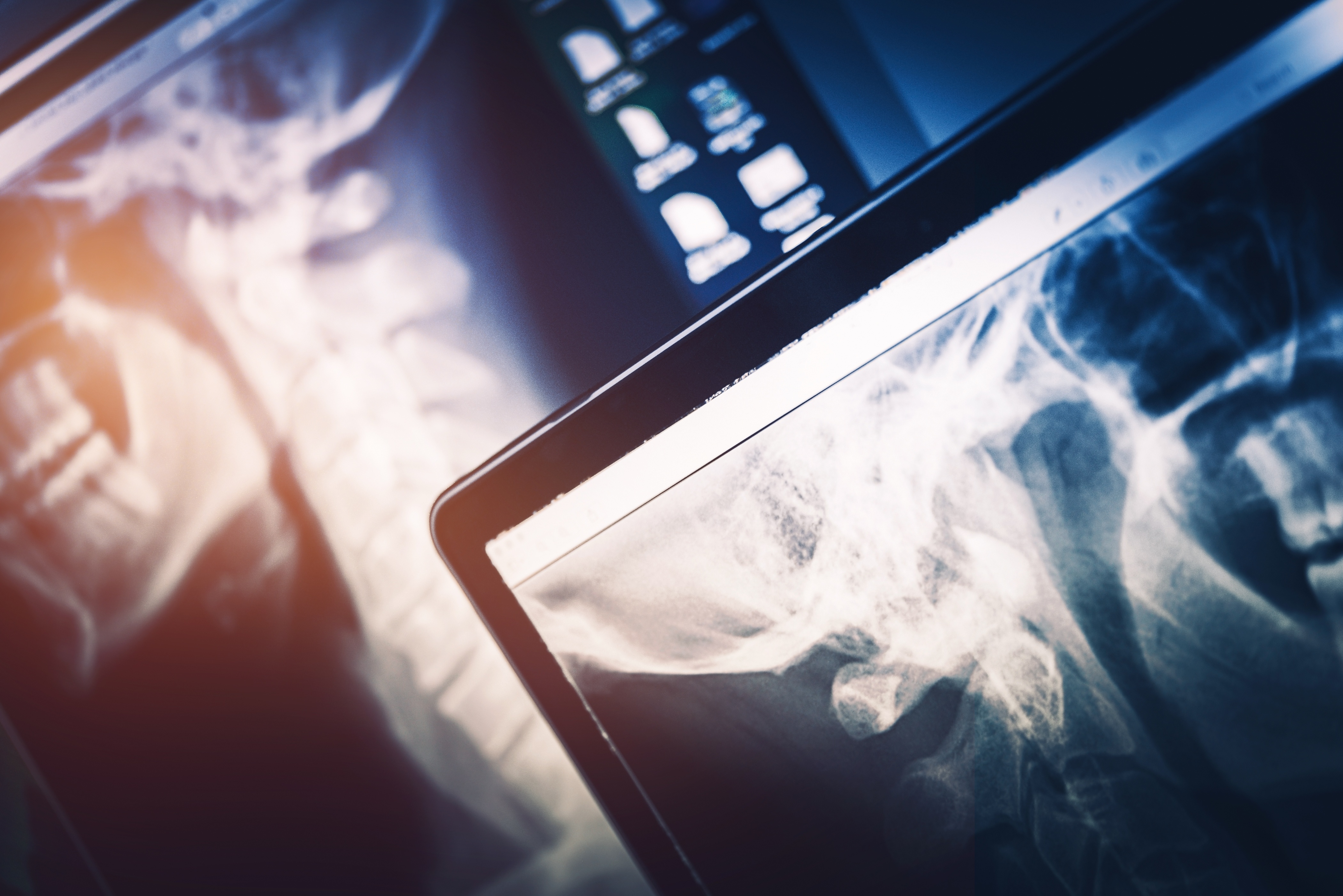How Radiologists Can Help Identify Domestic Violence
