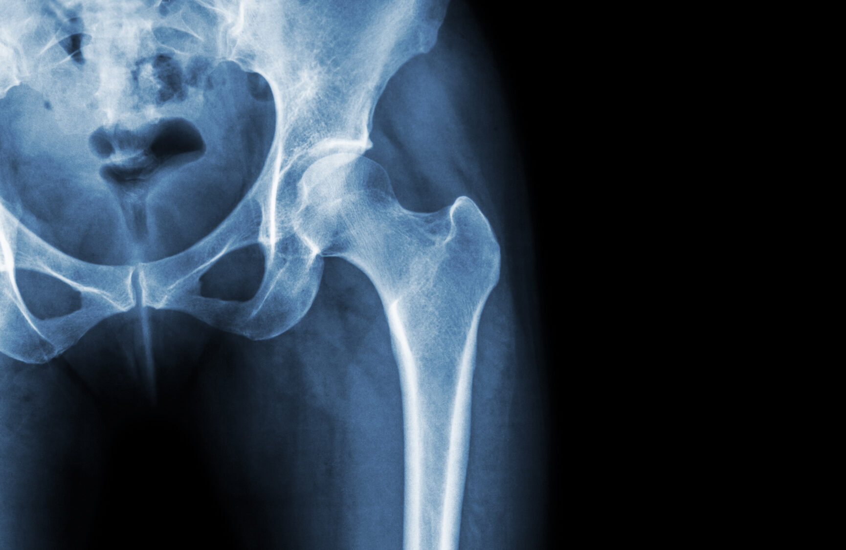 Radiology Offers Clues In Cases Of Domestic Abuse And Sexual Assault