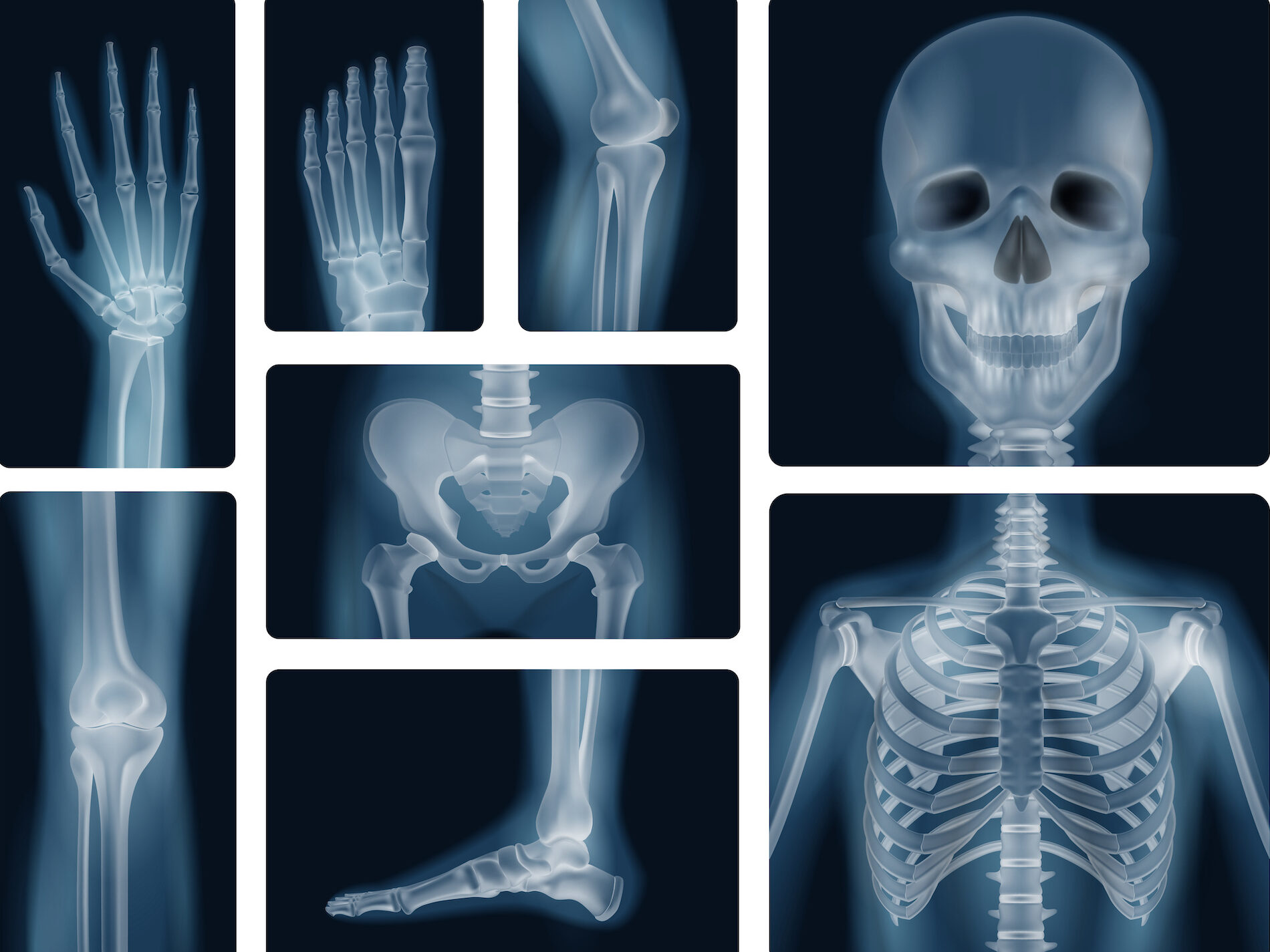 X-Rays Could Provide Crucial Clues In Identifying Domestic Violence