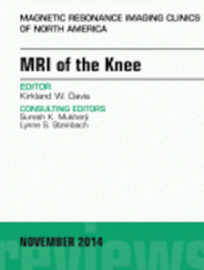 A Biomechanical Approach To Interpreting Magnetic Resonance Imaging Of Knee Injuries